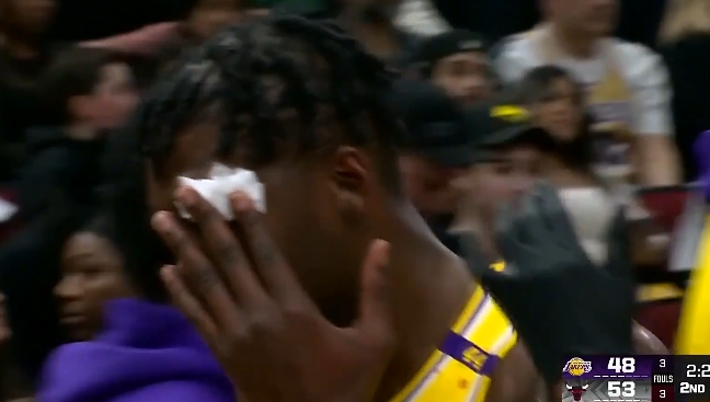 電風(fēng)扇和許爾特卡位沖撞導(dǎo)致眼角出血 隨后怒推后者發(fā)泄&離場治療